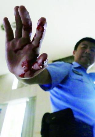 　由于培訓(xùn)全是真刀真槍，一民警的手被“匪徒”砍傷 攝 法制晚報記者 曹博遠(yuǎn)