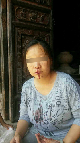 被打的產(chǎn)婦陸某。