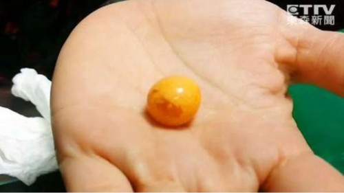 椰子螺吐出美樂(lè)珠，圖為老板娘撿到的美樂(lè)珠