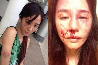 合肥女律師遭家暴 究竟有何深仇大恨挑斷妻子手筋腳筋？(組圖)