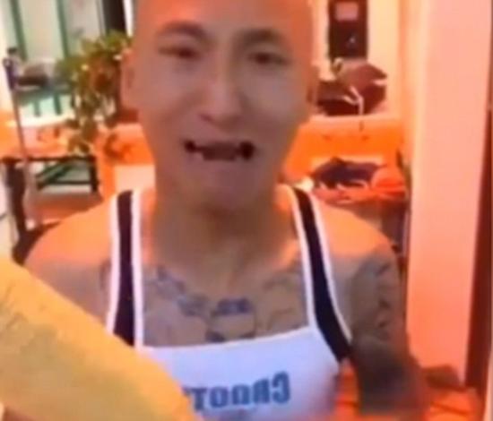 男子表示從來(lái)沒(méi)想到會(huì)是這個(gè)結(jié)果的，看到自己上下門牙掉光后幾乎處于崩潰邊緣。