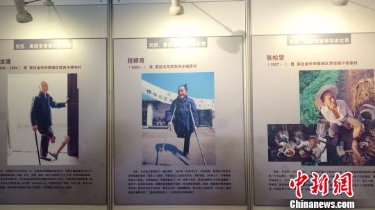 日軍在浙細(xì)菌戰(zhàn)受害幸存者的照片、悲慘遭遇口述 張煜歡 攝
