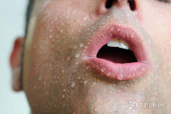 很容易出汗？暗示身體“故障”了！