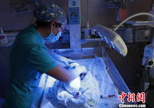 醫(yī)護人員對黃疸患兒進行護理?！畹?攝